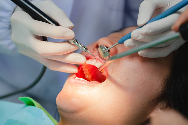 Atraktivní žena podstupuje stomatologickou léčbu a specialista v gumových rukavicích provádí vyšetření a vyléčení zubů pacienta. Perorální zdravotní koncepce.  - Fotografie, Obrázek