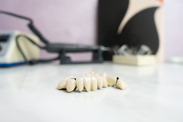 οδοντιατρικές κεραμικές μεταλλικές γέφυρες είναι στο τραπέζι - Φωτογραφία, εικόνα