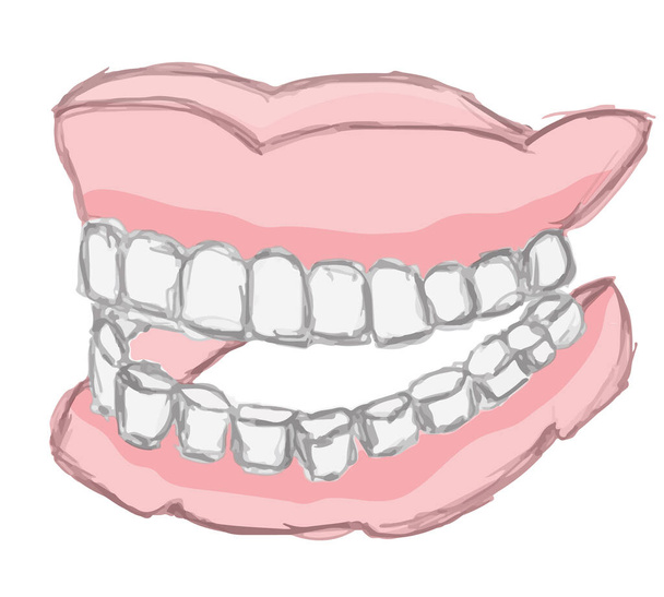 Denti falsi umani - protesi acrilica permanente. Schizzo della falsa dentiera. - Vettoriali, immagini