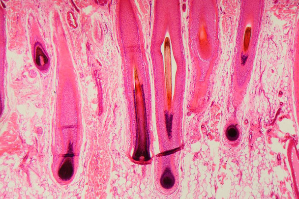Schnitt eines menschlichen Haarfollikels in der Haut unter dem Mikroskop - Foto, Bild