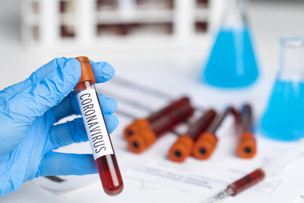 Technician holding blood tube test in the research laboratory. Coronavirus testing. Doctor taking a blood sample tube - Фото, зображення