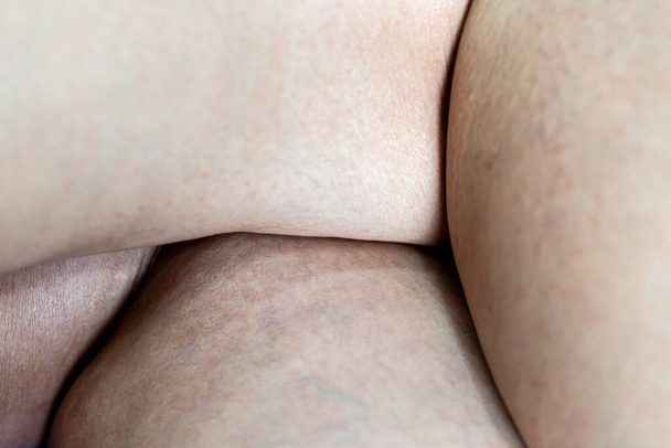 Piel seca de la mujer en la pantorrilla de la pierna - Foto, imagen