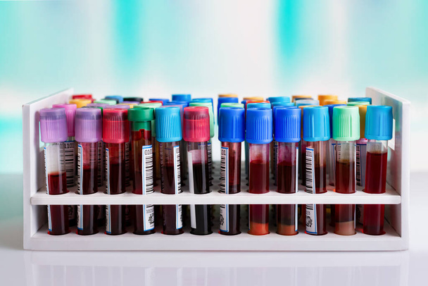 Hematoloji laboratuarında analiz için hastalardan alınan kan örnekleriyle dolu raflar. Analiz laboratuarında test için kan tüpleri içeren tüp tepsisi. - Fotoğraf, Görsel