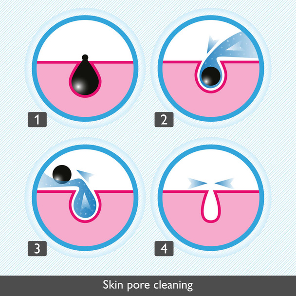 Iconos de proceso de limpieza de poros de la piel. Tratamientos faciales iconos de colores. Tratamiento de enfermedades de la piel, eliminación de sebo y limpieza y estrechamiento de los poros. Ilustración del vector médico - Vector, imagen