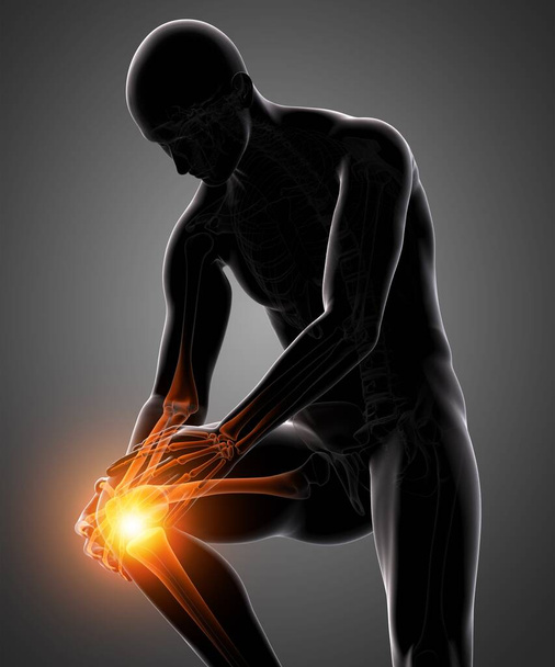 膝の痛みを骨格脚の解剖学で3Dレンダリングします。 - 写真・画像