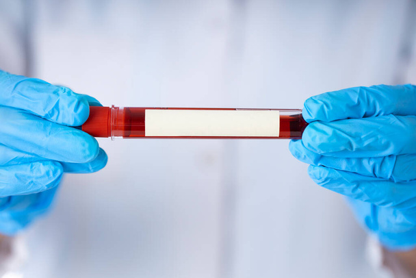 Technician holding blood tube test in the research laboratory. Coronavirus testing. - Zdjęcie, obraz
