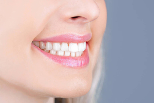 Bělení zubů. Zubní zdravotní koncepce. Postup bělení zubů. Zubařská péče. Zubní koncept. Perfektní zdravé zuby. Detailní záběr ženského zubatého úsměvu. Perfektní zdravé zuby úsměv žena - Fotografie, Obrázek