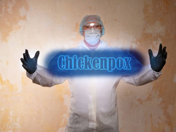 Healthcare concept meaning Chickenpox with inscription on the piece of paper - Photo, Image