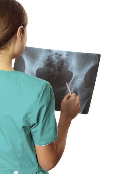 Женщина-врач осматривает рентгеновское изображение. Фокус на рентгеновском снимке
. - Фото, изображение