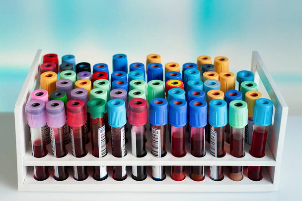 bandeja con muestras de sangre de tubos para examinarlas en el laboratorio del banco de sangre. estante con tubos con muestras de sangre tomadas de pacientes para su análisis en el laboratorio - Foto, imagen