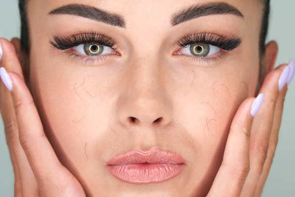 Woman with artificial eyelash loss problem. Fallen eyelashes all over the face - Fotoğraf, Görsel