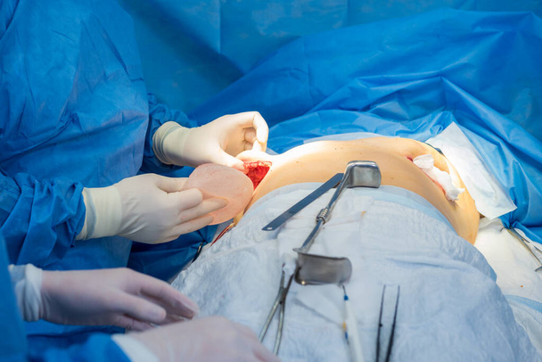 Breast augmentation under the guidance surgeons team in surgical operating room. - Foto, Imagen
