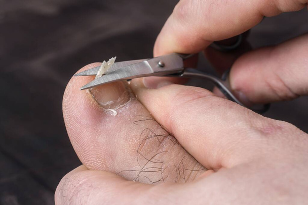 Homem cortando pregos em seu pé - conceito de pedicure - Foto, Imagem