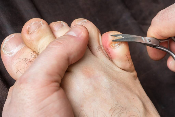 Mann schneidet Nägel am Fuß - Pediküre-Konzept - Foto, Bild