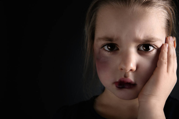 Little girl with bruises on face against dark background, space for text. Domestic violence victim - Photo, Image