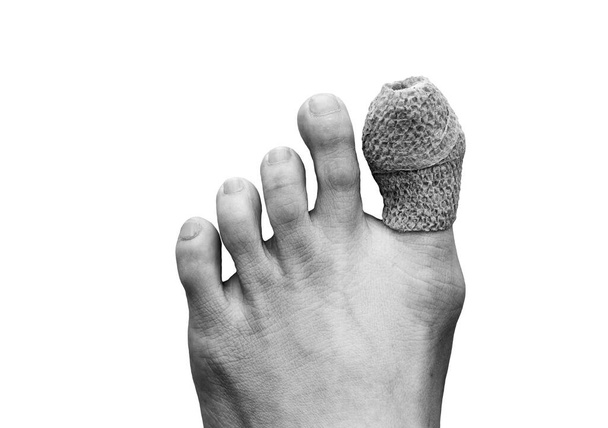 primer plano del pie derecho de la mujer con un herido en el dedo gordo del pie. Aislado sobre fondo blanco. Concepto de accidente y salud. Tono blanco y negro  - Foto, imagen