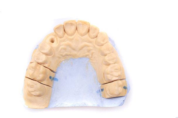 model protezy zęba izolowany na białym tle - Zdjęcie, obraz