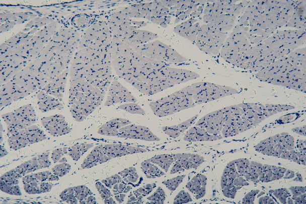 Menschliche Skelettmuskelzellen unter dem Mikroskop - Foto, Bild