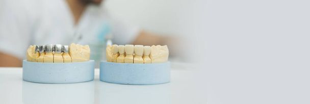 歯医者のテーブルの上にモックアゴ。歯の健康 - 写真・画像
