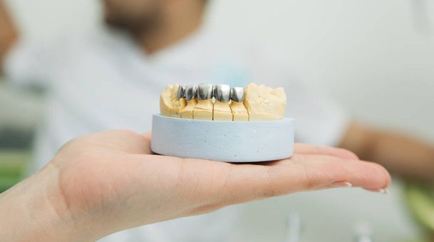 знущатися над щелепою на столі у стоматолога. здоров'я зубів
 - Фото, зображення