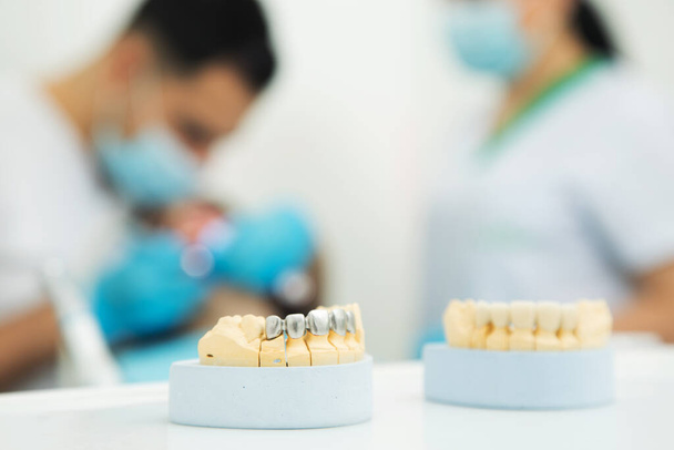 Állkapocs az asztalon a fogorvosnál. fogászati egészség - Fotó, kép