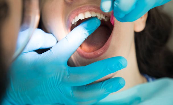 el dentista comprueba los dientes del paciente. salud dental - Foto, imagen