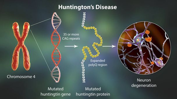Huntington-kór molekuláris genezise, 3D illusztráció. A CAG trinukleotid szekvencia kiterjesztése a htt génben mutáns vadászati fehérje termelését okozza, ami neurodegenerációhoz vezet. - Fotó, kép