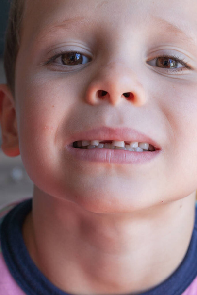 removing a baby tooth. Brave strong boy pulls out his own tooth. Loss of healthy baby teeth. - Valokuva, kuva