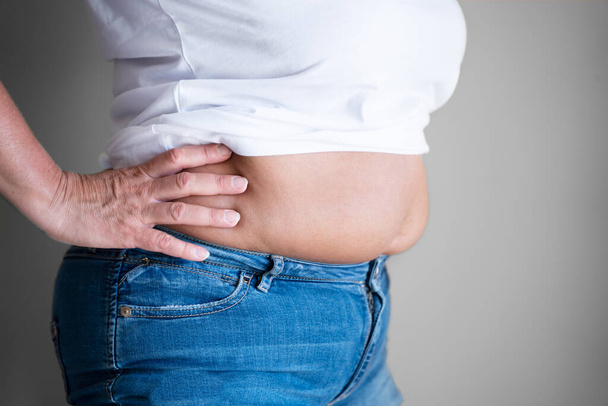 Fat Woman Belly Button And Body On Diet - Fotoğraf, Görsel