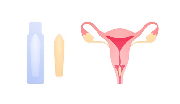 Female reproductive system illness treatment concept. Vector flat medical illustration. Suppository medicine apply in vagina and package isolated on white background. Design for healthcare, gynecology - Vetor, Imagem