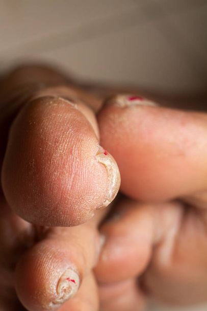 close-up van voet duim nagel stock foto - Foto, afbeelding
