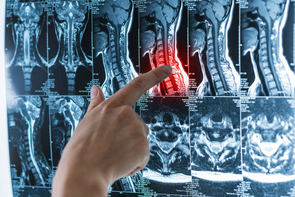 Omurga MR görüntüleri, kırmızı acı noktalı omurilik, osteokondrosis, skolyoz, manyetik rezonans görüntüleme konsepti olan eller. - Fotoğraf, Görsel