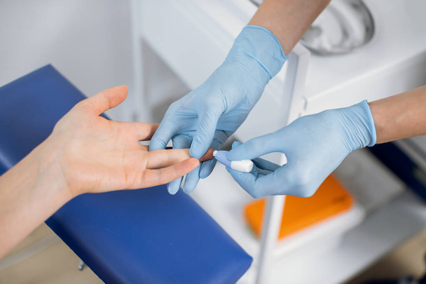 Close up of nurse lab technician in blue sterile gloves, using painless scarifier to prick the finger of unrecognizable patient, sitting on chair. Blood analysis and group determination. - Foto, afbeelding