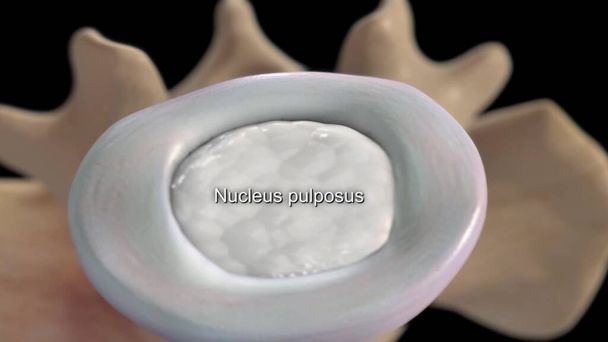 poprawny anatomicznie widok 3d kręgosłupa szyjnego kręgosłupa międzykręgowego -jądro pulposus - Zdjęcie, obraz