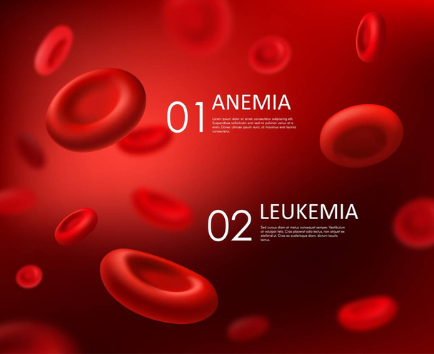 Anemia and leukemia, blood diseases vector background with red cells erythrocytes. Healthcare and hematology medicine, anemia and leukemia diseases, hemoglobin blood cells deficiency - Vector, Image