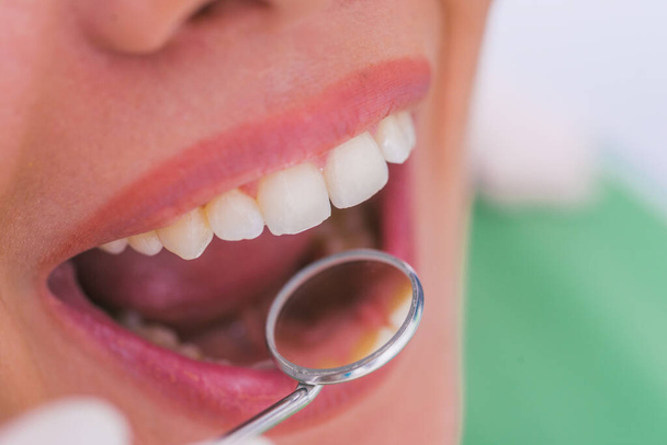 Fechamento de uma paciente do sexo feminino com a boca aberta durante o check-up oral no dentista. - Foto, Imagem
