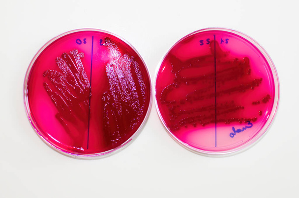 Τα βακτήρια E coli αναπτύσσουν χαρακτηριστικά σε επιλεκτικά μέσα - Φωτογραφία, εικόνα