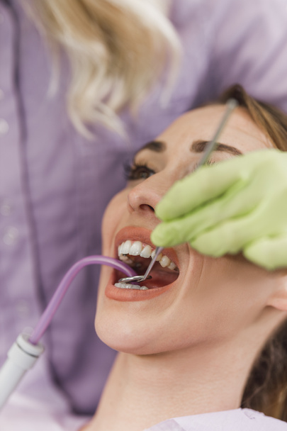Close-up de uma jovem mulher tendo trabalho dental feito em seus dentes. - Foto, Imagem
