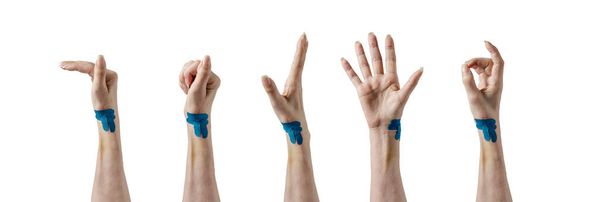 Wstępne ćwiczenia palców dłoni po operacji ścięgna. Blizna uzdrawiająca na kobiecej dłoni jest przymocowana plastrami na taśmach medycznych, chronionymi przed łzami. Pielęgnacja blizn, rehabilitacja ruchów dłoni - Zdjęcie, obraz