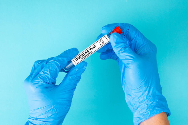 Doctor hand in blue gloves holding a test tube sample with positive COVID-19 virus. - Photo, Image