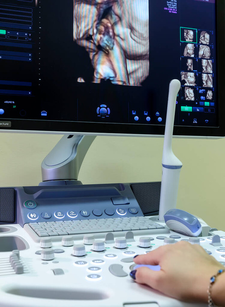 jonge vrouw arts handen close-up voorbereiding voor een echografie apparaat scan. - Foto, afbeelding