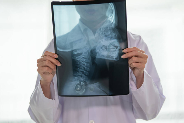 Young Asian Female Doctor showing x-ray results to patient, Vertebral Column Cervical, Healthcare and Medical concept - Photo, image