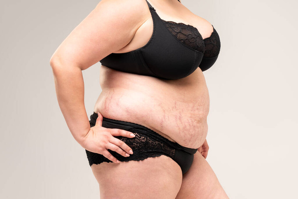 Fat woman in black lingerie, overweight female body with stretch marks on gray background, plastic surgery concept - Foto, immagini