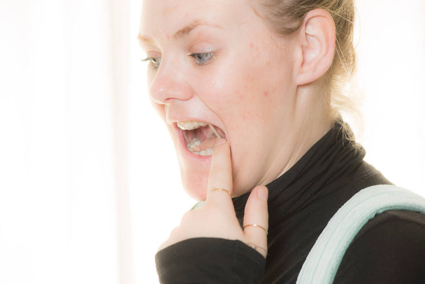la dentición o conjunto de dientes de una mujer rubia - Foto, Imagen