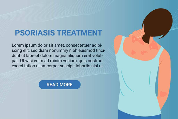Psoriasis treatment banner with woman is scratching her back. Allergic itching, skin inflammation, redness and irritation. Atopic dermatitis, eczema, psoriasis, dry skin. Skin problems Concept, vector. - Vector, Image
