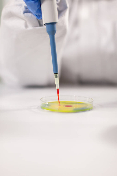 Крупним планом вчений скидає зразки крові за допомогою мікропіпетки
 - Фото, зображення