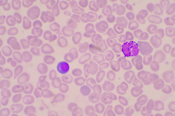 нуклеированные красные кровяные тельца (nrc) в мазке крови. - Фото, изображение