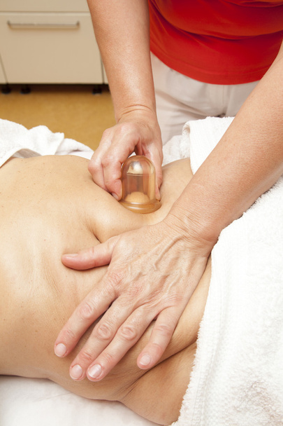 Anti-Cellulite-Massage mit Ventuza-Vakuum-Abzieher - Foto, Bild