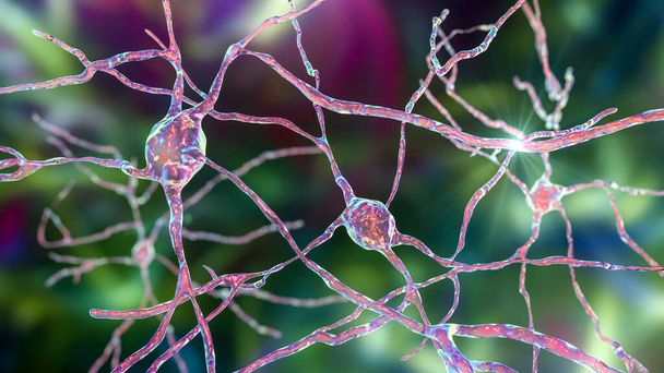 Нейроны Dorsal striatum, трехмерная иллюстрация. Дорсальная стриатум является ядром в базальных ганглиях, деградация его нейронов играет решающую роль в развитии болезни Хантингтона - Фото, изображение
