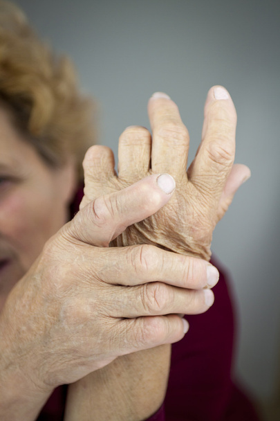 Mains de femme déformée de la polyarthrite rhumatoïde
 - Photo, image